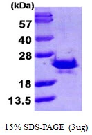 3microg Human Sorcin protein (GTX67848-pro) by SDS-PAGE under reducing condition and visualized by coomassie blue stain. 3microg Human Sorcin protein (GTX67848-pro) by SDS-PAGE under reducing condition and visualized by coomassie blue stain.