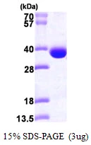 3microg Human SRM protein (GTX67851-pro) by SDS-PAGE under reducing condition and visualized by coomassie blue stain. 3microg Human SRM protein (GTX67851-pro) by SDS-PAGE under reducing condition and visualized by coomassie blue stain.