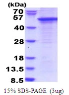 3microg Human STAC protein (GTX67856-pro) by SDS-PAGE under reducing condition and visualized by coomassie blue stain. 3microg Human STAC protein (GTX67856-pro) by SDS-PAGE under reducing condition and visualized by coomassie blue stain.