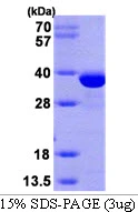 3microg Human Estrogen Sulfotransferase protein (GTX67858-pro) by SDS-PAGE under reducing condition and visualized by coomassie blue stain. 3microg Human Estrogen Sulfotransferase protein (GTX67858-pro) by SDS-PAGE under reducing condition and visualized by coomassie blue stain.