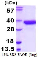 3?g Human SULT1A2 protein (GTX67861-pro) by SDS-PAGE under reducing condition and visualized by coomassie blue stain.