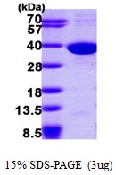 3microg Human SULT1C2 protein (GTX67863-pro) by SDS-PAGE under reducing condition and visualized by coomassie blue stain. 3microg Human SULT1C2 protein (GTX67863-pro) by SDS-PAGE under reducing condition and visualized by coomassie blue stain.