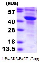 3microg Human SULT2B1 protein (GTX67864-pro) by SDS-PAGE under reducing condition and visualized by coomassie blue stain. 3microg Human SULT2B1 protein (GTX67864-pro) by SDS-PAGE under reducing condition and visualized by coomassie blue stain.