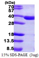 3microg Human SULT2A1 protein (GTX67865-pro) by SDS-PAGE under reducing condition and visualized by coomassie blue stain. 3microg Human SULT2A1 protein (GTX67865-pro) by SDS-PAGE under reducing condition and visualized by coomassie blue stain.