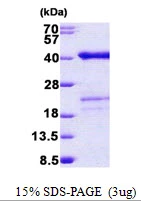 3microg Human SURF2 protein (GTX67866-pro) by SDS-PAGE under reducing condition and visualized by coomassie blue stain.