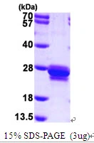 3microg Human Transgelin protein (GTX67867-pro) by SDS-PAGE under reducing condition and visualized by coomassie blue stain. 3microg Human Transgelin protein (GTX67867-pro) by SDS-PAGE under reducing condition and visualized by coomassie blue stain.