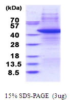 3microg Human TRBP2 protein (GTX67869-pro) by SDS-PAGE under reducing condition and visualized by coomassie blue stain. 3microg Human TRBP2 protein (GTX67869-pro) by SDS-PAGE under reducing condition and visualized by coomassie blue stain.