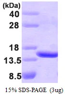 3microg Human TBCA protein (GTX67871-pro) by SDS-PAGE under reducing condition and visualized by coomassie blue stain. 3microg Human TBCA protein (GTX67871-pro) by SDS-PAGE under reducing condition and visualized by coomassie blue stain.