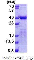 3microg Human TFIIS protein (GTX67874-pro) by SDS-PAGE under reducing condition and visualized by coomassie blue stain. 3microg Human TFIIS protein (GTX67874-pro) by SDS-PAGE under reducing condition and visualized by coomassie blue stain.