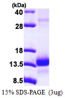 3microg Human TCEB1 protein (GTX67875-pro) by SDS-PAGE under reducing condition and visualized by coomassie blue stain. 3microg Human TCEB1 protein (GTX67875-pro) by SDS-PAGE under reducing condition and visualized by coomassie blue stain.