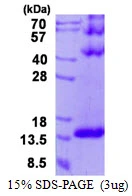 3microg Human DYNLT3 protein (GTX67879-pro) by SDS-PAGE under reducing condition and visualized by coomassie blue stain. 3microg Human DYNLT3 protein (GTX67879-pro) by SDS-PAGE under reducing condition and visualized by coomassie blue stain.