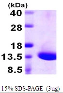 3microg Human DYNLT1 protein (GTX67881-pro) by SDS-PAGE under reducing condition and visualized by coomassie blue stain. 3microg Human DYNLT1 protein (GTX67881-pro) by SDS-PAGE under reducing condition and visualized by coomassie blue stain.