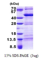 3microg Human TEF protein (GTX67884-pro) by SDS-PAGE under reducing condition and visualized by coomassie blue stain. 3microg Human TEF protein (GTX67884-pro) by SDS-PAGE under reducing condition and visualized by coomassie blue stain.