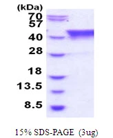 3microg Human TIAL1 protein (GTX67887-pro) by SDS-PAGE under reducing condition and visualized by coomassie blue stain. 3microg Human TIAL1 protein (GTX67887-pro) by SDS-PAGE under reducing condition and visualized by coomassie blue stain.