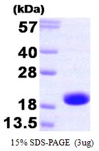 3microg Human Troponin C fast skeletal protein (GTX67890-pro) by SDS-PAGE under reducing condition and visualized by coomassie blue stain. 3microg Human Troponin C fast skeletal protein (GTX67890-pro) by SDS-PAGE under reducing condition and visualized by coomassie blue stain.