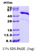 3microg Human Cardiac Troponin T protein (GTX67895-pro) by SDS-PAGE under reducing condition and visualized by coomassie blue stain. 3microg Human Cardiac Troponin T protein (GTX67895-pro) by SDS-PAGE under reducing condition and visualized by coomassie blue stain.