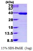 3microg Human Tropomyosin 1 protein (GTX67897-pro) by SDS-PAGE under reducing condition and visualized by coomassie blue stain. 3microg Human Tropomyosin 1 protein (GTX67897-pro) by SDS-PAGE under reducing condition and visualized by coomassie blue stain.