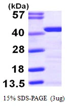 3microg Human Tropomyosin 2 protein (GTX67898-pro) by SDS-PAGE under reducing condition and visualized by coomassie blue stain. 3microg Human Tropomyosin 2 protein (GTX67898-pro) by SDS-PAGE under reducing condition and visualized by coomassie blue stain.