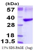 3microg Human Tropomyosin 3 protein (GTX67899-pro) by SDS-PAGE under reducing condition and visualized by coomassie blue stain. 3microg Human Tropomyosin 3 protein (GTX67899-pro) by SDS-PAGE under reducing condition and visualized by coomassie blue stain.