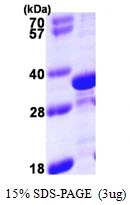 3microg Human Tropomyosin 4 protein (GTX67900-pro) by SDS-PAGE under reducing condition and visualized by coomassie blue stain. 3microg Human Tropomyosin 4 protein (GTX67900-pro) by SDS-PAGE under reducing condition and visualized by coomassie blue stain.