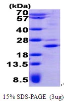 3microg Human TSSC3 protein (GTX67905-pro) by SDS-PAGE under reducing condition and visualized by coomassie blue stain. 3microg Human TSSC3 protein (GTX67905-pro) by SDS-PAGE under reducing condition and visualized by coomassie blue stain.