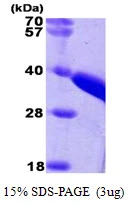 3&#956;g Human TST protein (GTX67906-pro) by SDS-PAGE under reducing condition and visualized by coomassie blue stain.