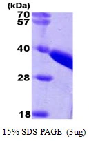 3μg Human TST protein (GTX67906-pro) by SDS-PAGE under reducing condition and visualized by coomassie blue stain.