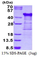 3microg Human TTC1 protein (GTX67908-pro) by SDS-PAGE under reducing condition and visualized by coomassie blue stain.
