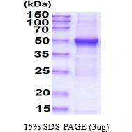 3microg Human TUBG1 protein (GTX67909-pro) by SDS-PAGE under reducing condition and visualized by coomassie blue stain. 3microg Human TUBG1 protein (GTX67909-pro) by SDS-PAGE under reducing condition and visualized by coomassie blue stain.