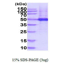 3microg Human TUBG1 protein (GTX67910-pro) by SDS-PAGE under reducing condition and visualized by coomassie blue stain. 3microg Human TUBG1 protein (GTX67910-pro) by SDS-PAGE under reducing condition and visualized by coomassie blue stain.