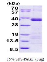 3microg Human U2AF35 protein (GTX67912-pro) by SDS-PAGE under reducing condition and visualized by coomassie blue stain. 3microg Human U2AF35 protein (GTX67912-pro) by SDS-PAGE under reducing condition and visualized by coomassie blue stain.