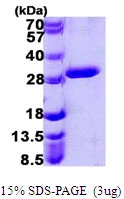 3microg Human UROS protein (GTX67934-pro) by SDS-PAGE under reducing condition and visualized by coomassie blue stain. 3microg Human UROS protein (GTX67934-pro) by SDS-PAGE under reducing condition and visualized by coomassie blue stain.
