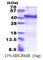 3microg Human USF1 protein (GTX67935-pro) by SDS-PAGE under reducing condition and visualized by coomassie blue stain. 3microg Human USF1 protein (GTX67935-pro) by SDS-PAGE under reducing condition and visualized by coomassie blue stain.