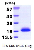 3microg Human Visinin-like 1 protein (GTX67938-pro) by SDS-PAGE under reducing condition and visualized by coomassie blue stain. 3microg Human Visinin-like 1 protein (GTX67938-pro) by SDS-PAGE under reducing condition and visualized by coomassie blue stain.