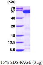 3microg Human Tryptophanyl tRNA synthetase protein (GTX67939-pro) by SDS-PAGE under reducing condition and visualized by coomassie blue stain. 3microg Human Tryptophanyl tRNA synthetase protein (GTX67939-pro) by SDS-PAGE under reducing condition and visualized by coomassie blue stain.