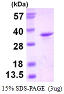 3microg Human eIF4H protein (GTX67940-pro) by SDS-PAGE under reducing condition and visualized by coomassie blue stain. 3microg Human eIF4H protein (GTX67940-pro) by SDS-PAGE under reducing condition and visualized by coomassie blue stain.