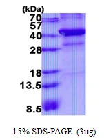 3microg Human XRCC3 protein (GTX67942-pro) by SDS-PAGE under reducing condition and visualized by coomassie blue stain. 3microg Human XRCC3 protein (GTX67942-pro) by SDS-PAGE under reducing condition and visualized by coomassie blue stain.
