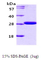 3microg Human 14-3-3 gamma protein (GTX67944-pro) by SDS-PAGE under reducing condition and visualized by coomassie blue stain. 3microg Human 14-3-3 gamma protein (GTX67944-pro) by SDS-PAGE under reducing condition and visualized by coomassie blue stain.