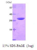 3microg Human 14-3-3 eta protein (GTX67945-pro) by SDS-PAGE under reducing condition and visualized by coomassie blue stain. 3microg Human 14-3-3 eta protein (GTX67945-pro) by SDS-PAGE under reducing condition and visualized by coomassie blue stain.