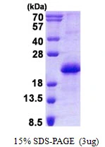 3microg Human CNBP protein (GTX67948-pro) by SDS-PAGE under reducing condition and visualized by coomassie blue stain.