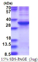 3microg Human ZNF32 protein (GTX67949-pro) by SDS-PAGE under reducing condition and visualized by coomassie blue stain. 3microg Human ZNF32 protein (GTX67949-pro) by SDS-PAGE under reducing condition and visualized by coomassie blue stain.