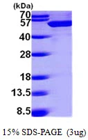 3microg Human UAP56 protein (GTX67954-pro) by SDS-PAGE under reducing condition and visualized by coomassie blue stain. 3microg Human UAP56 protein (GTX67954-pro) by SDS-PAGE under reducing condition and visualized by coomassie blue stain.