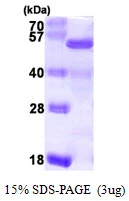 3microg Human NELF-E protein (GTX67956-pro) by SDS-PAGE under reducing condition and visualized by coomassie blue stain. 3microg Human NELF-E protein (GTX67956-pro) by SDS-PAGE under reducing condition and visualized by coomassie blue stain.