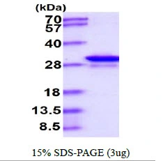 3microg Human GAS41 protein (GTX67961-pro) by SDS-PAGE under reducing condition and visualized by coomassie blue stain. 3microg Human GAS41 protein (GTX67961-pro) by SDS-PAGE under reducing condition and visualized by coomassie blue stain.