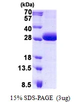 3microg Human DGCR6 protein (GTX67966-pro) by SDS-PAGE under reducing condition and visualized by coomassie blue stain. 3microg Human DGCR6 protein (GTX67966-pro) by SDS-PAGE under reducing condition and visualized by coomassie blue stain.