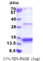 3microg Human 4E-BP3 protein (GTX67988-pro) by SDS-PAGE under reducing condition and visualized by coomassie blue stain. 3microg Human 4E-BP3 protein (GTX67988-pro) by SDS-PAGE under reducing condition and visualized by coomassie blue stain.