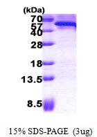 3?g Human CDC123 protein (GTX68011-pro) by SDS-PAGE under reducing condition and visualized by coomassie blue stain.