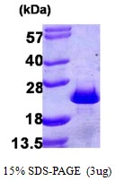 3?g Human PDCD6 protein (GTX68104-pro) by SDS-PAGE under reducing condition and visualized by coomassie blue stain.