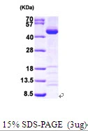 3&#956;g Human SAE1 protein (GTX68108-pro) by SDS-PAGE under reducing condition and visualized by coomassie blue stain.