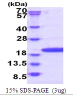 3?g Human POP7 protein (GTX68131-pro) by SDS-PAGE under reducing condition and visualized by coomassie blue stain.